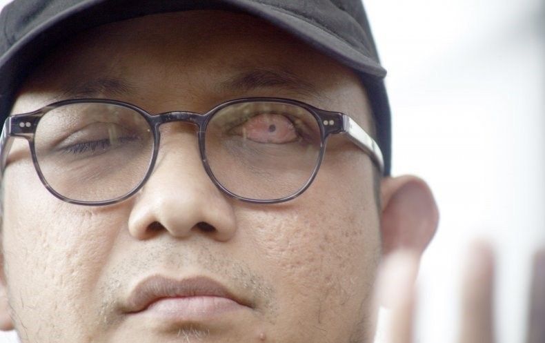 podiumnews.com-Istri Novel Baswedan Terkonfirmasi Positif COVID-19